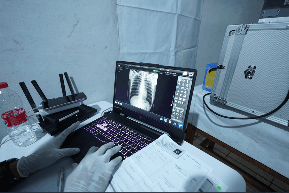 X-ray