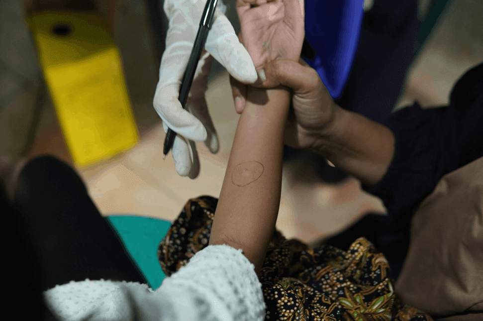 Provision and Access to TB Services